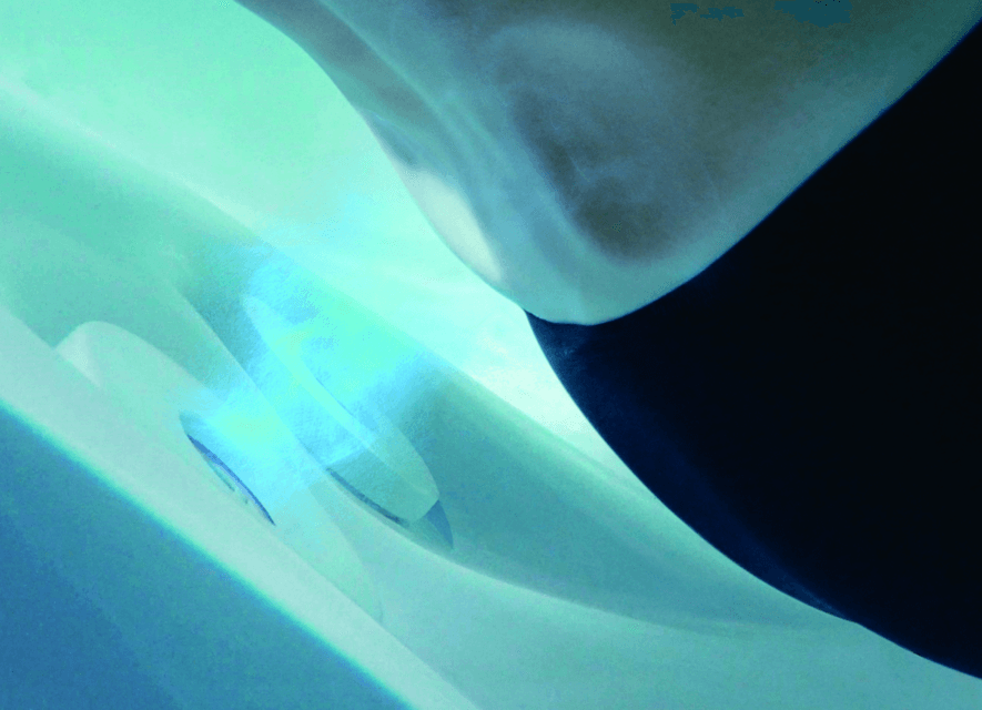 TOTO Flotation ZERO DIMENSION, varianta alb lucios (Glossy White) 5